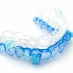 sleep apnea mouth guard for Columbus Ohio dental patients